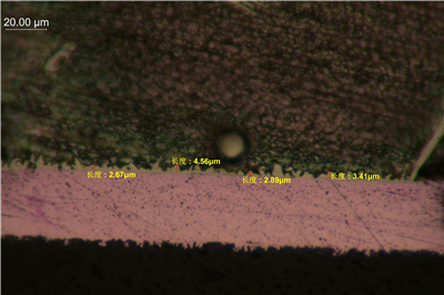 ���þ��취�۲� IMC ��̳�